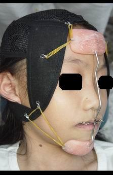 火狐电竞官方网站